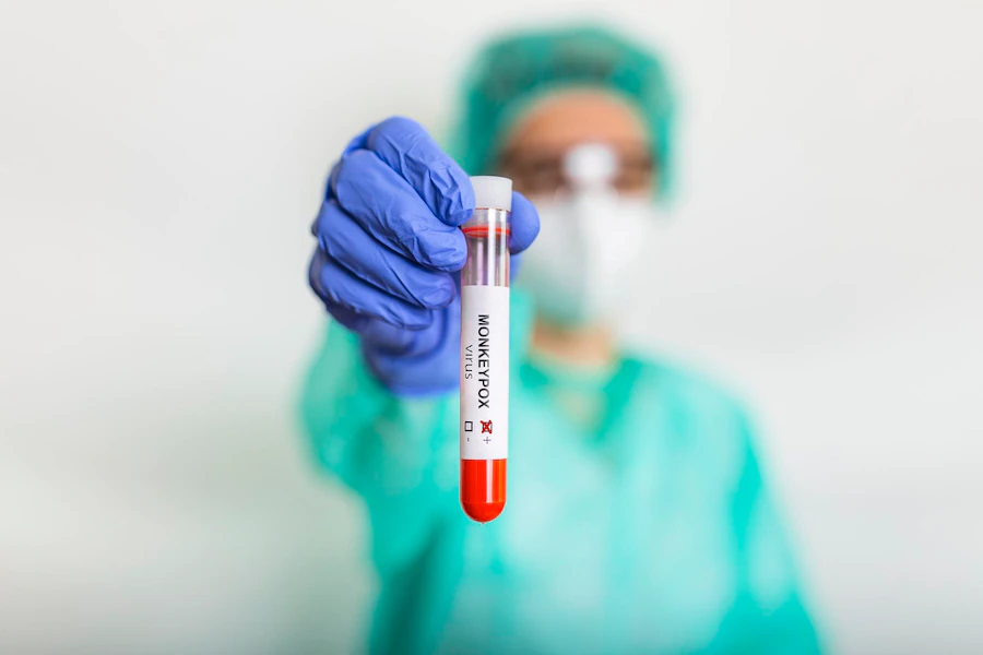 Monkeypox vaccination