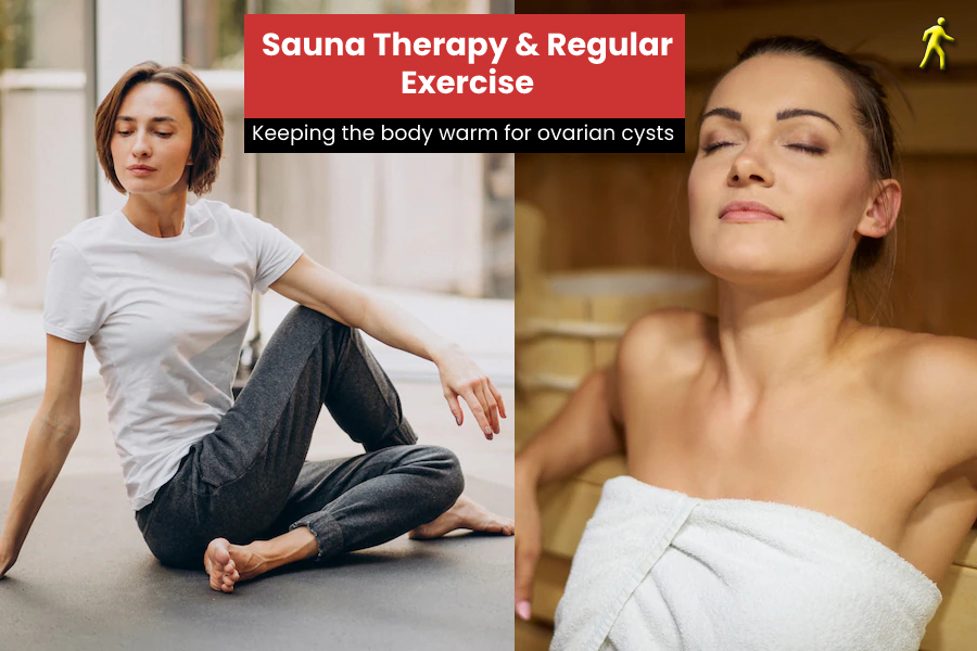 Sauna Therapy & Regular Exercise  for ovarian cysts